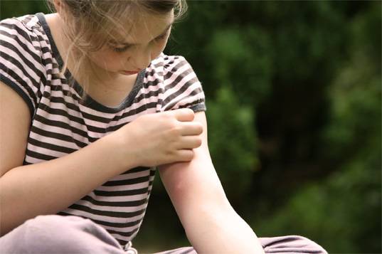 Evita las picaduras de mosquitos y protege tu piel este verano